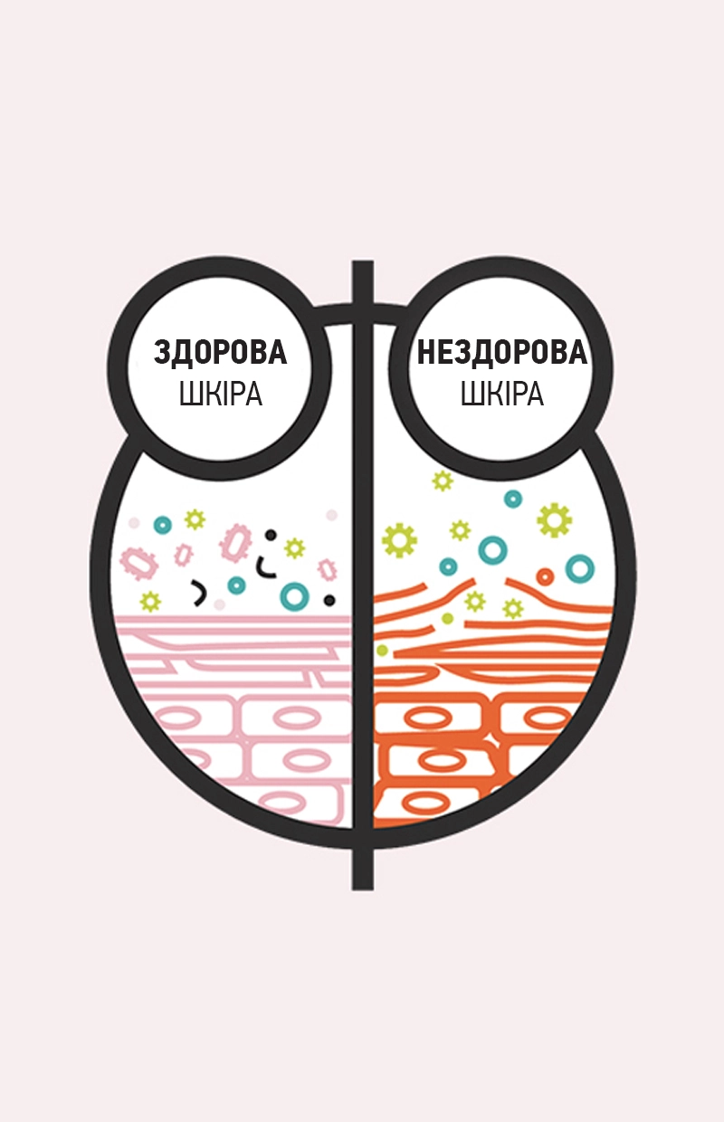 Ilustracja pokazująca różnicę między zdrową a niezdrową skórą.